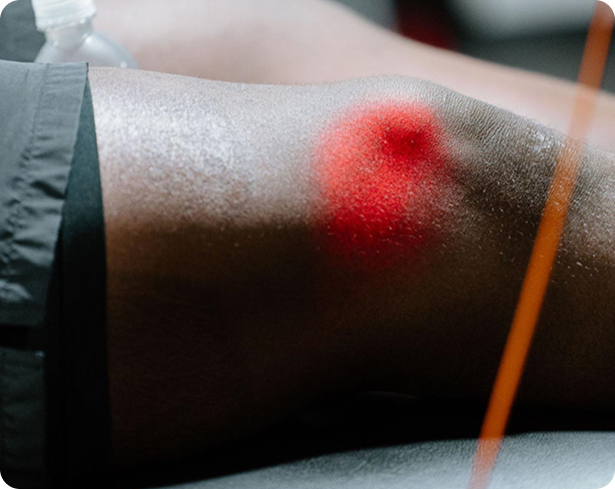 BioRestore Laser Therapy Laser Therapy for Muscle Stimulation & Tissue Healing in Frisco, TX